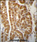 ROBLD3 Antibody (Center)